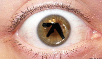 hagenplug
